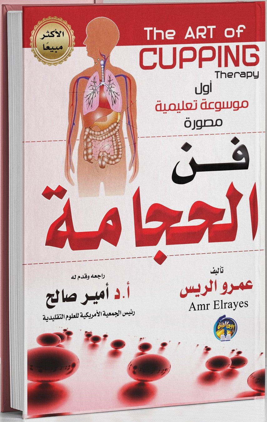 فن الحجامة